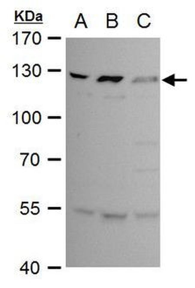 BCL11B Antibody in Western Blot (WB)