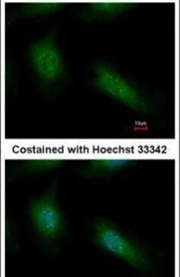 NFkB p50 Antibody in Immunocytochemistry (ICC/IF)