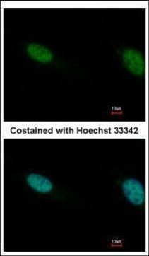 PBRM1 Antibody in Immunocytochemistry (ICC/IF)