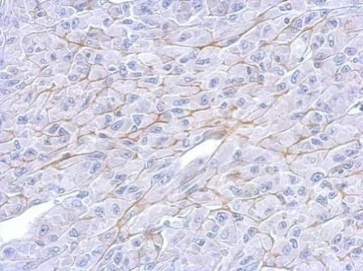 LOX Antibody in Immunohistochemistry (Paraffin) (IHC (P))