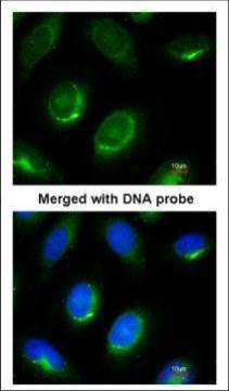 Laminin beta-1 Antibody in Immunocytochemistry (ICC/IF)