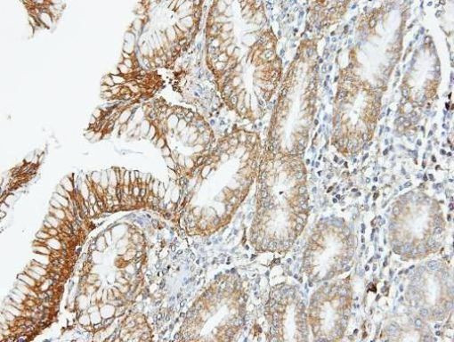 BMPR1A Antibody in Immunohistochemistry (Paraffin) (IHC (P))