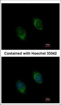 BMP-4 Antibody in Immunocytochemistry (ICC/IF)