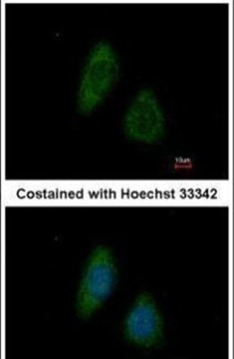 BMP-4 Antibody in Immunocytochemistry (ICC/IF)