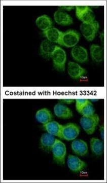 Thymidine Phosphorylase Antibody in Immunocytochemistry (ICC/IF)