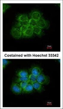 Crk Antibody in Immunocytochemistry (ICC/IF)