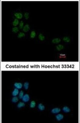 SRF Antibody in Immunocytochemistry (ICC/IF)