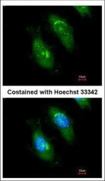 SMN1 Antibody in Immunocytochemistry (ICC/IF)