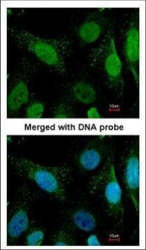 WRN Antibody in Immunocytochemistry (ICC/IF)