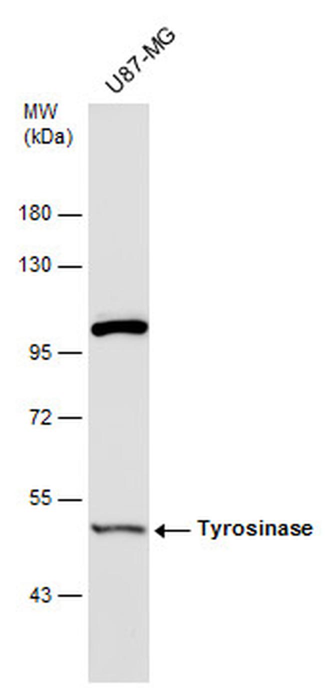 Tyrosinase Antibody in Western Blot (WB)