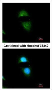 Cytochrome P450 Reductase Antibody in Immunocytochemistry (ICC/IF)