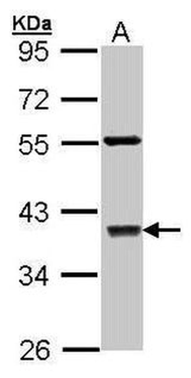 c-Jun Antibody in Western Blot (WB)