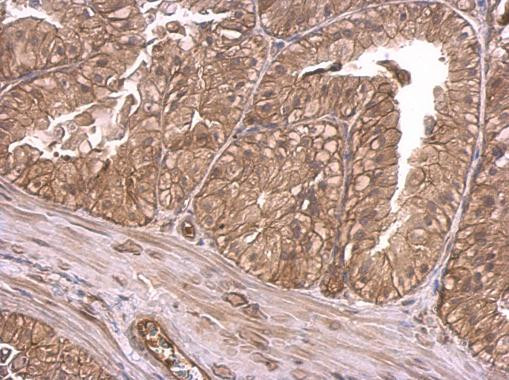 INSR Antibody in Immunohistochemistry (Paraffin) (IHC (P))