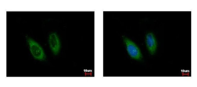 IKK gamma Antibody in Immunocytochemistry (ICC/IF)