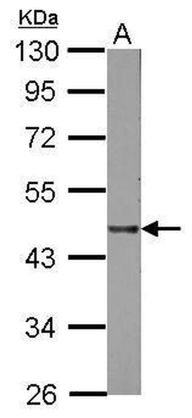 LIPA Antibody in Western Blot (WB)