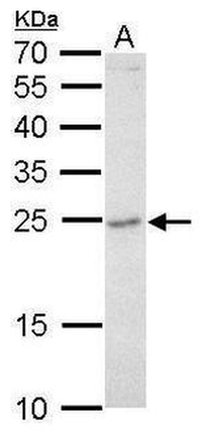 GRB2 Antibody in Western Blot (WB)