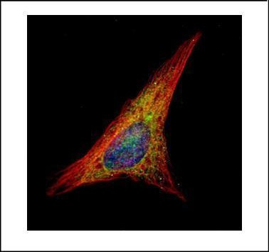Gelsolin Antibody in Immunocytochemistry (ICC/IF)