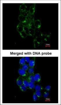 Fyn Antibody in Immunocytochemistry (ICC/IF)