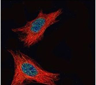 FMRP Antibody in Immunocytochemistry (ICC/IF)