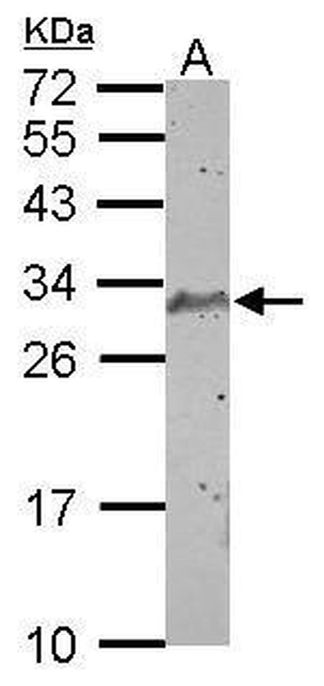 SCP3 Antibody in Western Blot (WB)