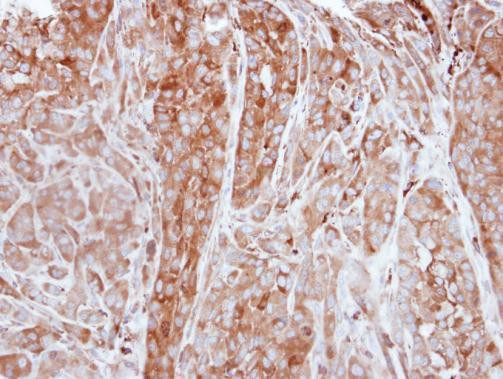 Ferritin Light Chain Antibody in Immunohistochemistry (Paraffin) (IHC (P))