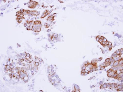 Maspin Antibody in Immunohistochemistry (Paraffin) (IHC (P))