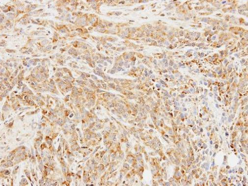 Butyrylcholinesterase Antibody in Immunohistochemistry (Paraffin) (IHC (P))