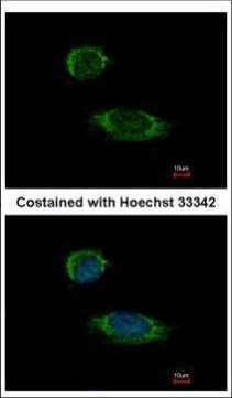 Caspase 1 Antibody in Immunocytochemistry (ICC/IF)