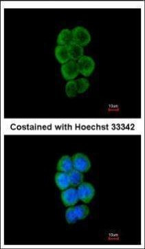 c-Cbl Antibody in Immunocytochemistry (ICC/IF)