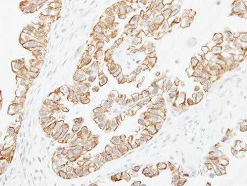 ADCY2 Antibody in Immunohistochemistry (Paraffin) (IHC (P))