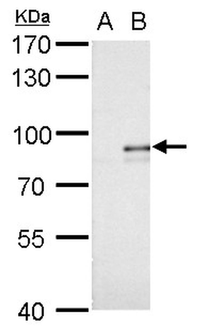 AGPS Antibody in Western Blot (WB)