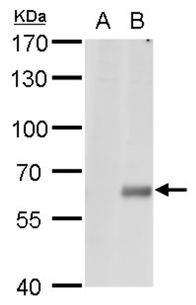 CPNE1 Antibody in Western Blot (WB)
