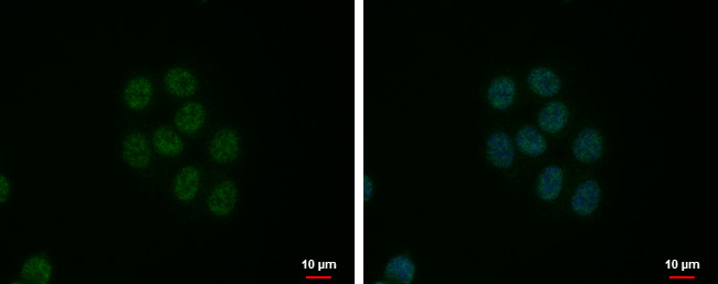 SRSF9 Antibody in Immunocytochemistry (ICC/IF)