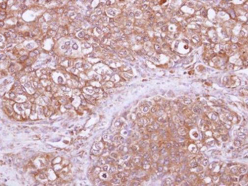 RhoGAP Antibody in Immunohistochemistry (Paraffin) (IHC (P))