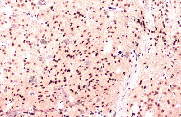 PTBP1 Antibody in Immunohistochemistry (Paraffin) (IHC (P))