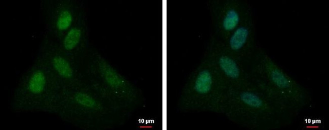 PSMD11 Antibody in Immunocytochemistry (ICC/IF)