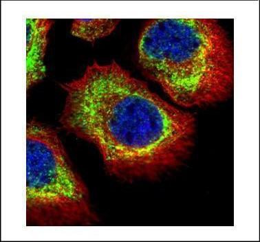 alpha Adducin Antibody in Immunocytochemistry (ICC/IF)
