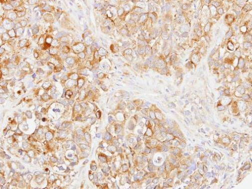 DOK1 Antibody in Immunohistochemistry (Paraffin) (IHC (P))