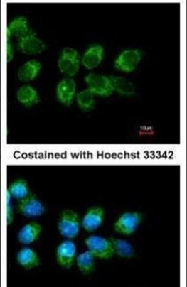 Folate Receptor alpha Antibody in Immunocytochemistry (ICC/IF)