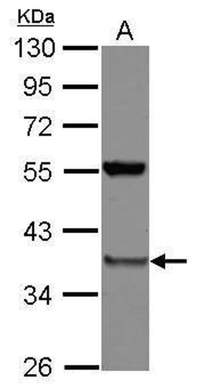 PSMD8 Antibody in Western Blot (WB)