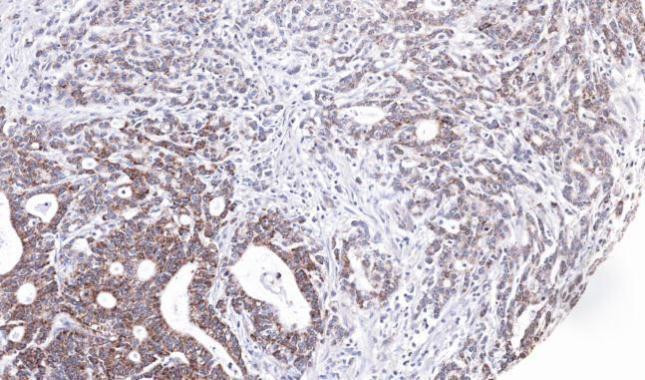 UBE2M Antibody in Immunohistochemistry (Paraffin) (IHC (P))
