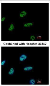 CHD4 Antibody in Immunocytochemistry (ICC/IF)