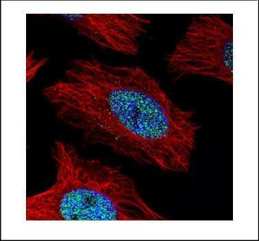 alpha Actinin 4 Antibody in Immunocytochemistry (ICC/IF)