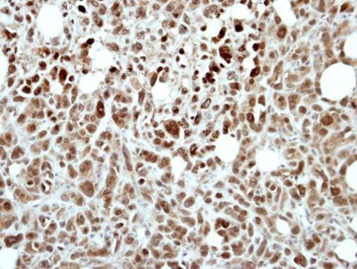 RING1 Antibody in Immunohistochemistry (Paraffin) (IHC (P))