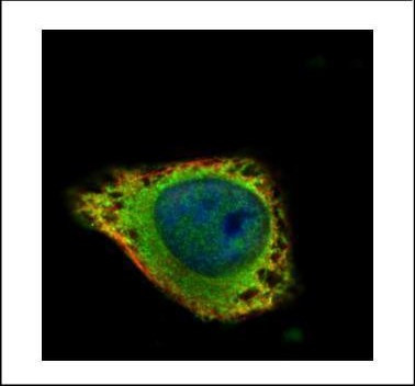 GRK2 Antibody in Immunocytochemistry (ICC/IF)