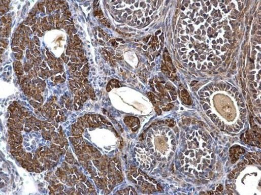 SDHA Antibody in Immunohistochemistry (Paraffin) (IHC (P))