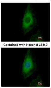 PP2A beta Antibody in Immunocytochemistry (ICC/IF)