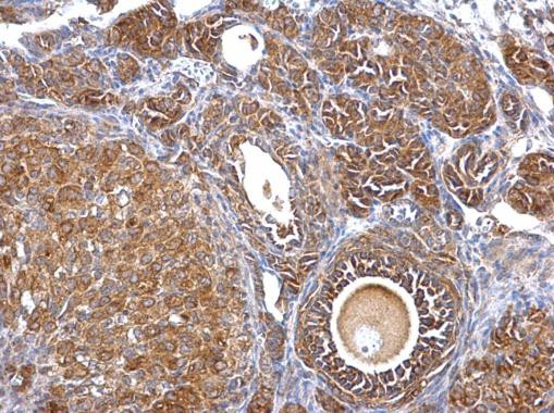 Septin 2 Antibody in Immunohistochemistry (Paraffin) (IHC (P))