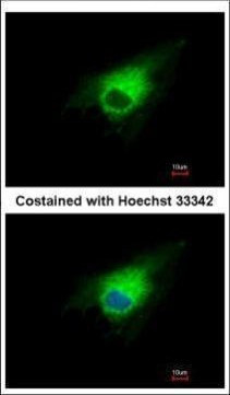 PGD Antibody in Immunocytochemistry (ICC/IF)