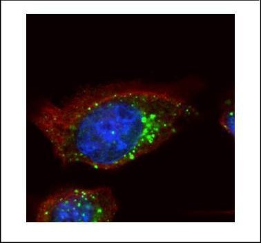 HGS Antibody in Immunocytochemistry (ICC/IF)